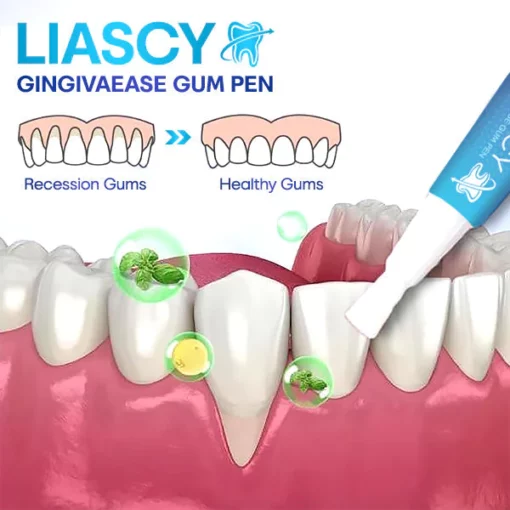 Liascy™ GingivaEase Gum Pen
