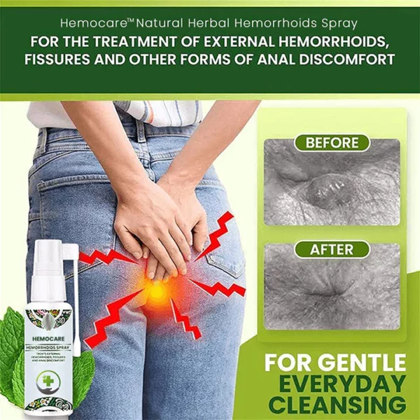 Hemocare Japanese Herbal Hemorrhoids Spray