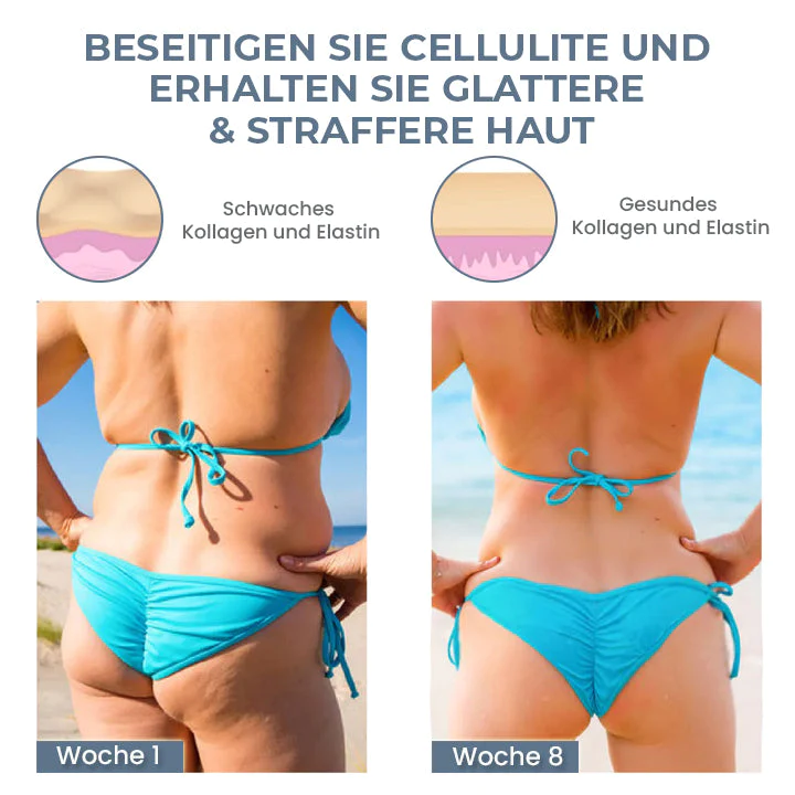 Oveallgo™ Intensiver X Hüftformender EMS-Trainer - Image 3