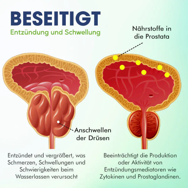 MediCare Prostata-Behandlungstropfen