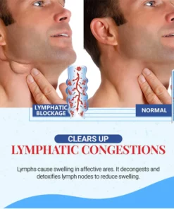 Oveallgo™ ULTRA Schildklier Lymfeklier Patch