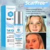 ScarFree™ Professional Advanced Cool Scar Treatment