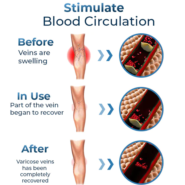 GFOUK™ Mucopolysaccharide Polysulfate Cream - Image 5
