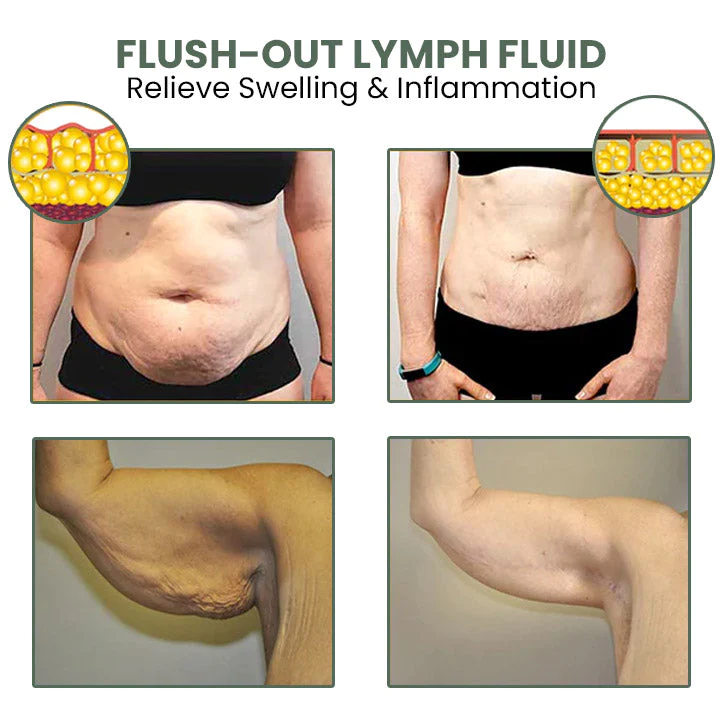 Oveallgo Profi Wermut CelluliteWegMit Hautstraffungscreme