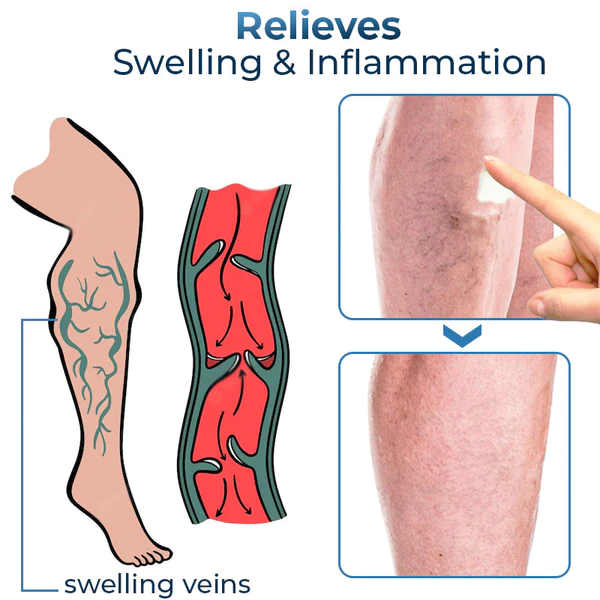 GFOUK™ Mucopolysaccharide Polysulfate Cream - Image 4