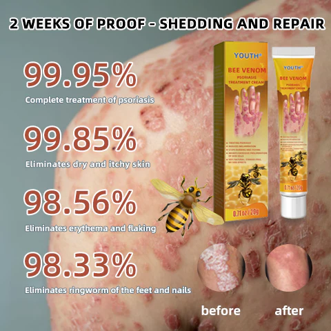 Crema Trattamentu di Psoriasis EdiJonah® - Image 4