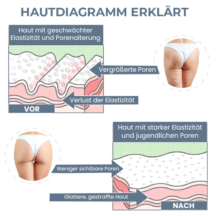 Oveallgo™ Intensiver X Hüftformender EMS-Trainer - Image 6