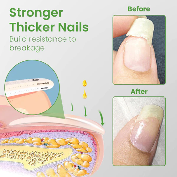 Ceoerty Nail Rescue Growth & Strengthening Roller