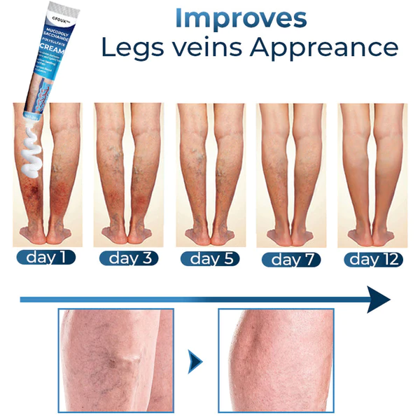 GFOUK™ Mucopolysaccharide Polysulfate Cream - Image 3