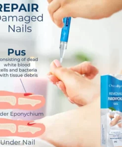 Alternative view of CC™ Removal Paronychia Gel