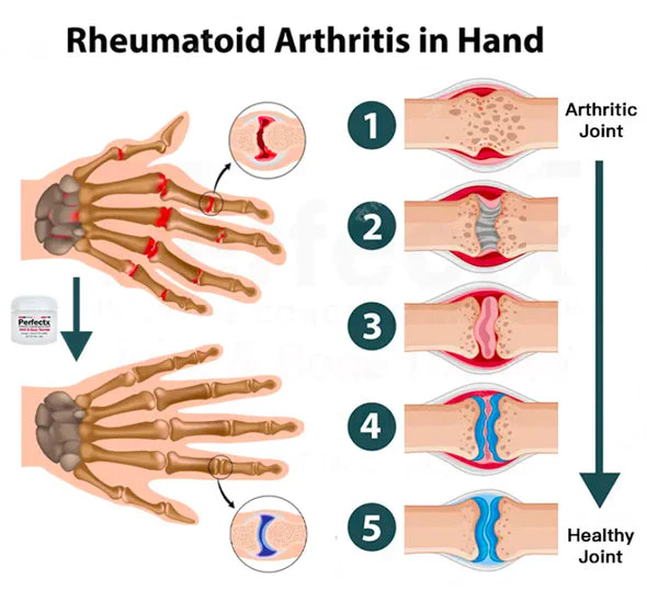 Flashing® New Zealand Bee Venom Professional Treatment Gel - Image 4