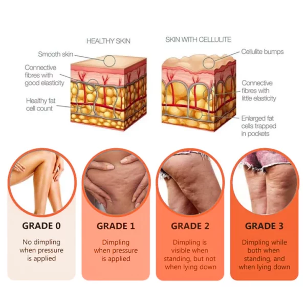 SkineticTM Grapefruit Anti-Cellulite Essential Oil