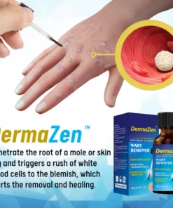 Alternative view of DermaZen™ Skin Tag Remover