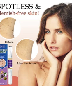 CCTM Tags & Moles Remover