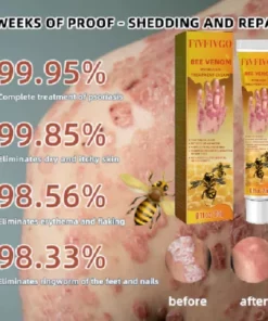 Alternative view of Fivfivgo™ Bee Venom Psoriasis Treatment Cream