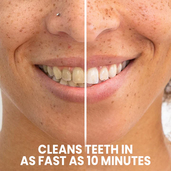 LIMETOW™ Teeth Whitening Pen - Image 11