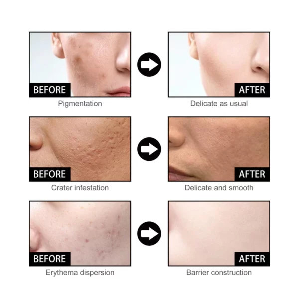 Niacin-Gesichtsessenz