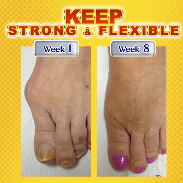 Humxf Joint & Bone Therapy Bee Venom Treatment Gel