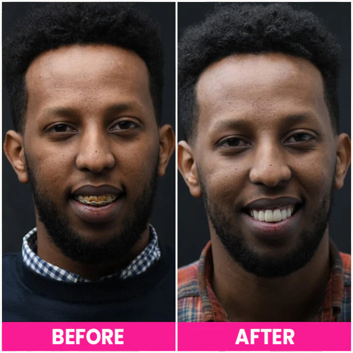 LIMETOW™ Teeth Whitening Pen - Image 6