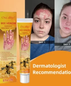 Oveallgo™ Bee Venom Psoriasis Treatment Cream