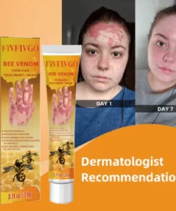 Fivfivgo™ Bee Venom Psoriasis Treatment Cream