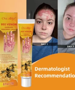 Oveallgo™ PRO Bienen Gift Psoriasis Behandlungscreme