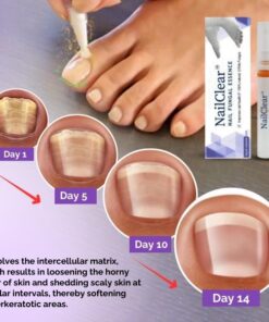 Alternative view of NailClear™ Nail Fungal Essence