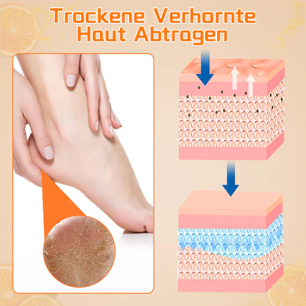 Biancat Hornhaut-Entfernendes FuAspray