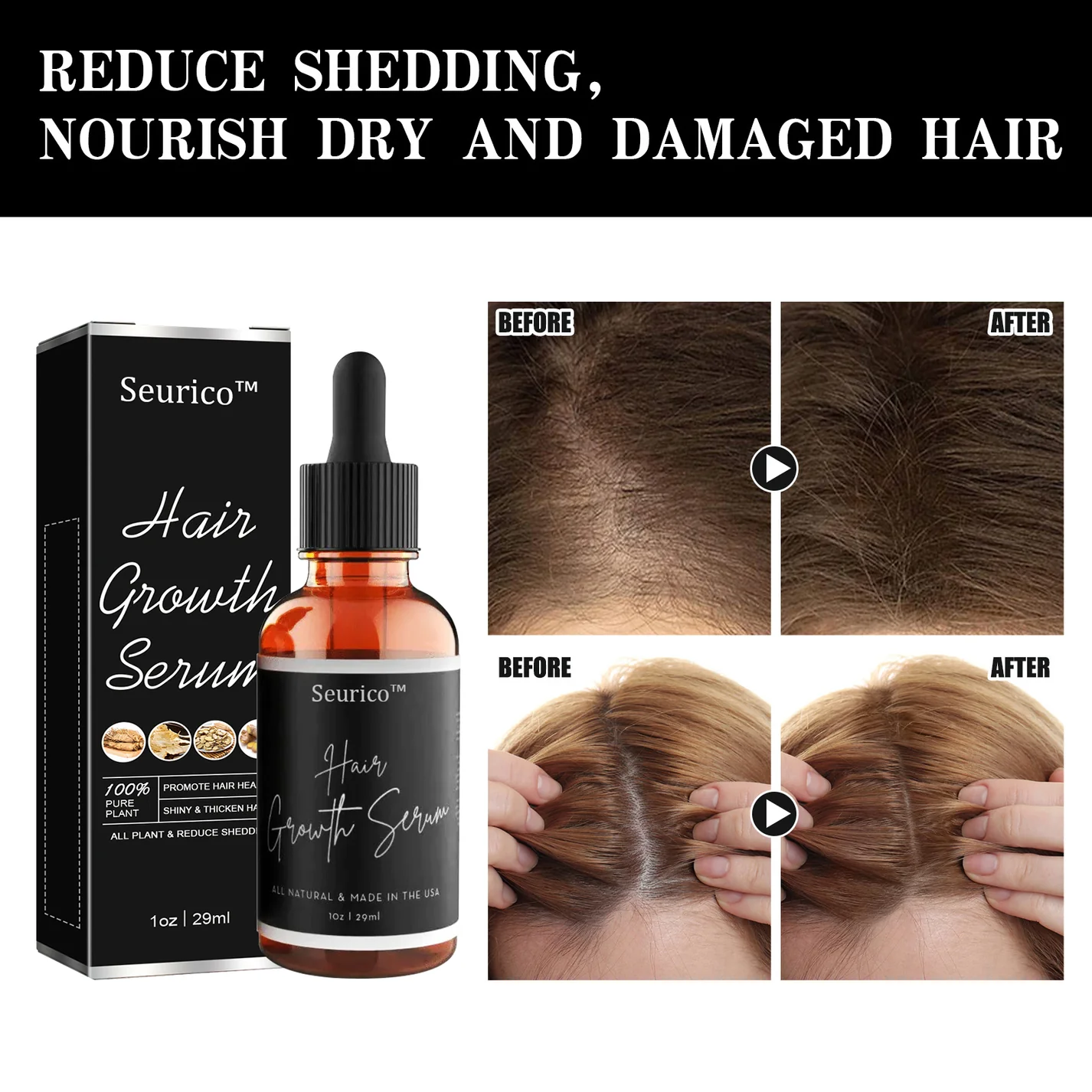 Seurico™ Natural Herbal Hair Growth Serum - Image 4