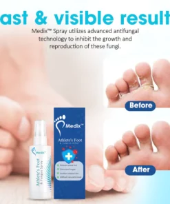 Alternative view of Medix™ Athlete’s Foot & Fungus Spray