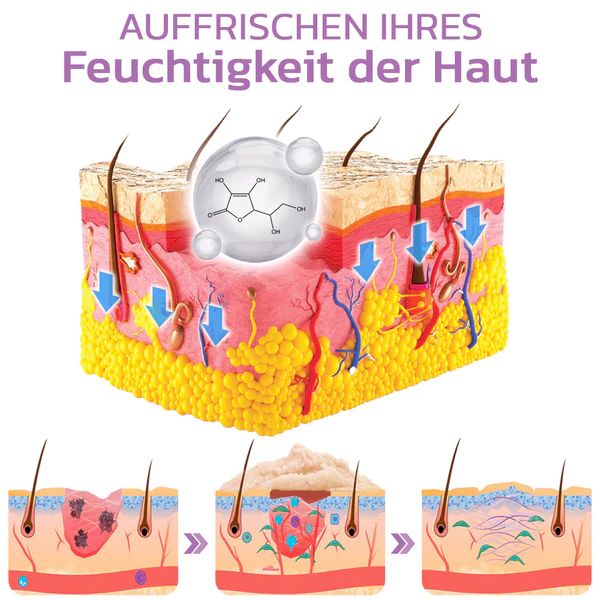 flysmus KP Keratose Gleichgewicht Radiergummi Krper Peeling