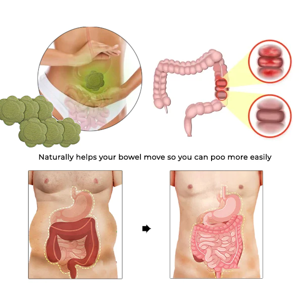 Oveallgo TruLax PRO Verstopfungspflaster