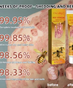Oveallgo™ PRO Bienen Gift Psoriasis Behandlungscreme