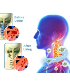 Alternative view of CoolTime™ Ion Lymphatic Relief Coolsculpting Neck Tube