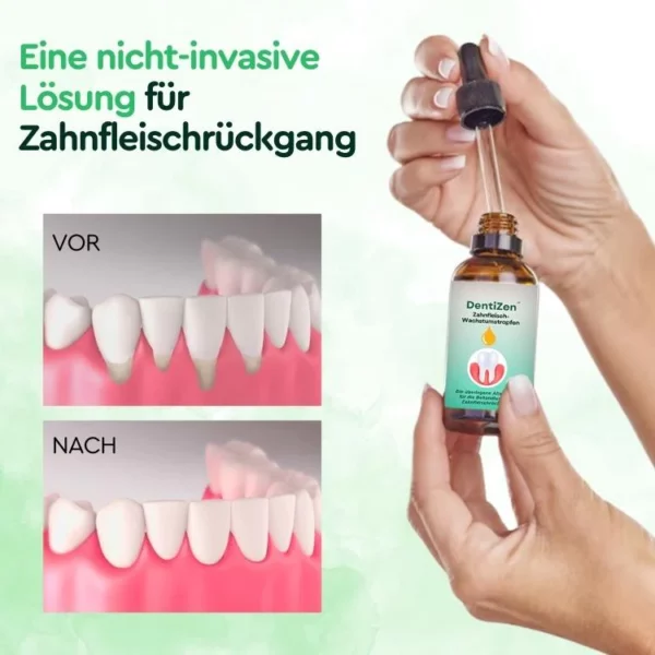 DentiZen ™ Zahnfleisch-Wachstumstropfen - Ìomhaigh 4