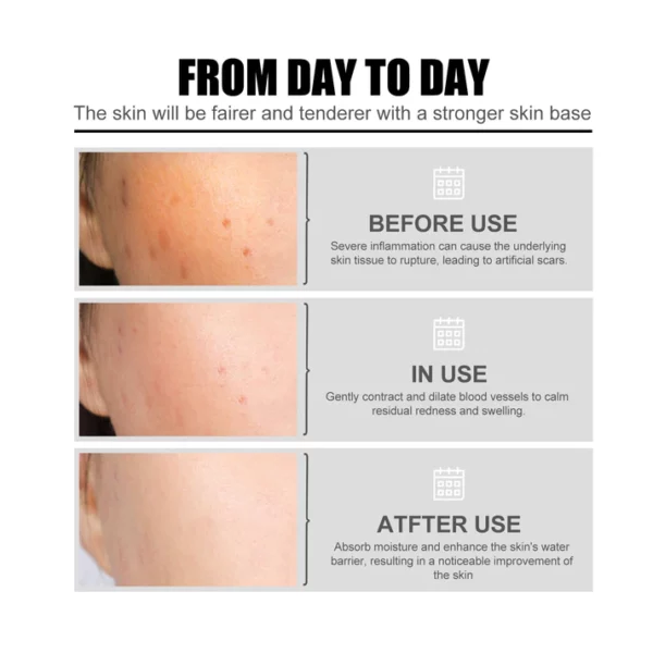 Niacin-Gesichtsessenz