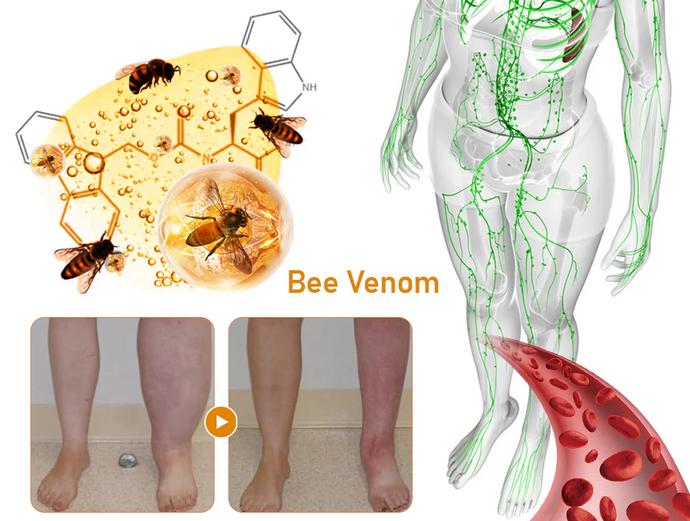 GFOUK™ Lymphatic Drainage & Foot slimming massage beads - Image 5