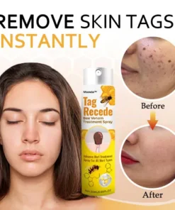 Alternative view of 𝗠𝗼𝗼𝗻𝗱𝗮𝗿™ 𝗧𝗮𝗴 𝗥𝗲𝗰𝗲𝗱𝗲 𝗕𝗲𝗲 𝗩𝗲𝗻𝗼𝗺 𝗧𝗿𝗲𝗮𝘁𝗺𝗲𝗻𝘁 𝗦𝗽𝗿𝗮𝘆