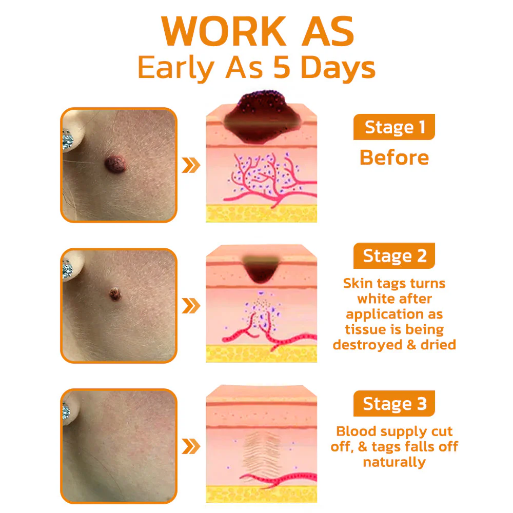 TagGone™ Bee Venom Treatment Gel - Image 4