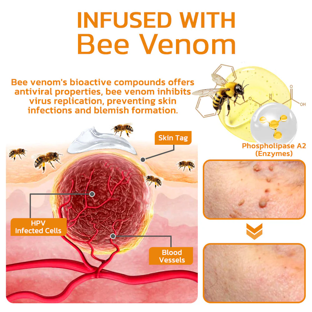 TagGone™ Bee Venom Treatment Gel - Image 3