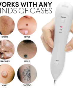 Oveallgo™ Spotfree Professional Electric Cosmetic Pen