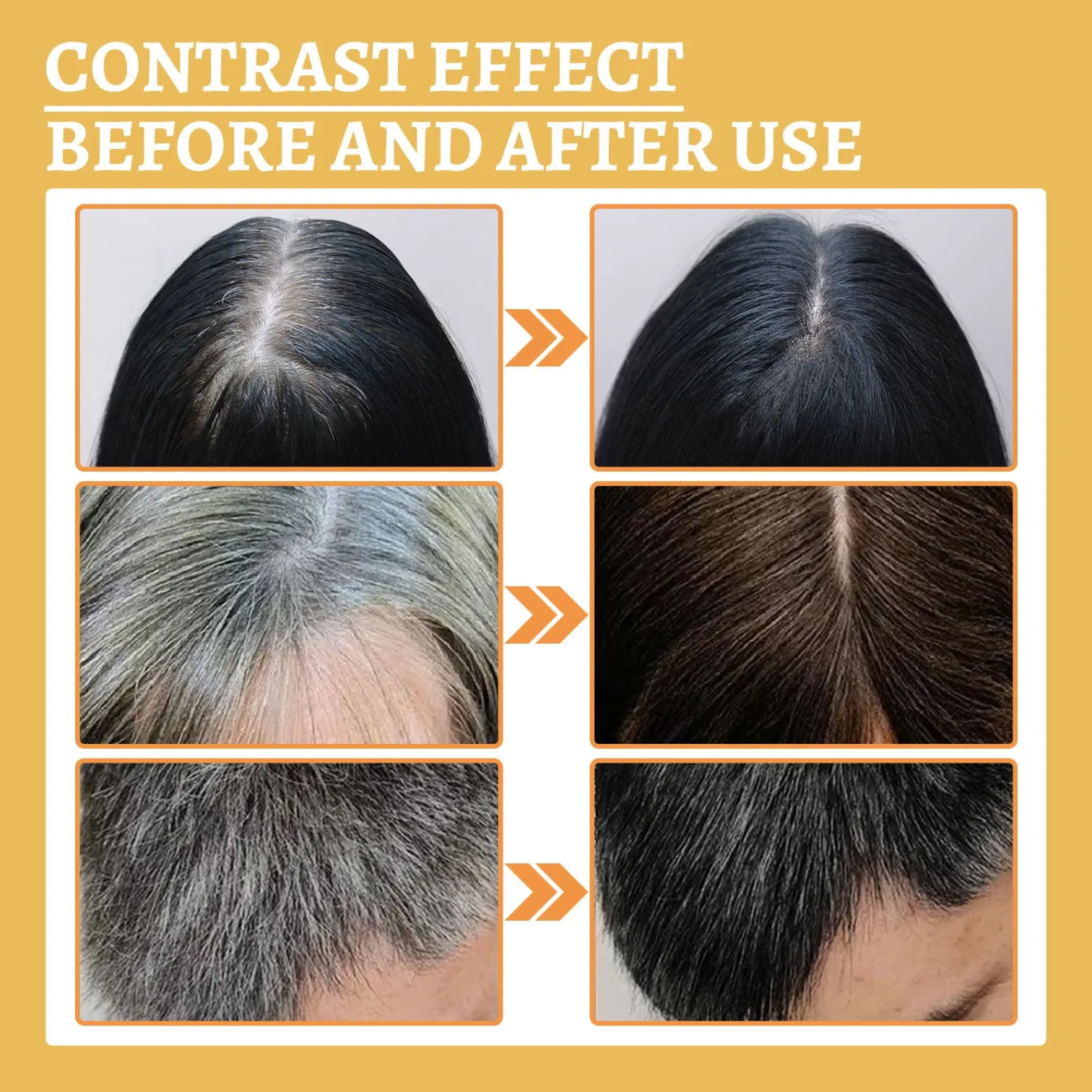 EELHOE Anti-Greying Hair Serum