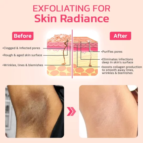 flysmus VIO Whitening Pinkish Essence