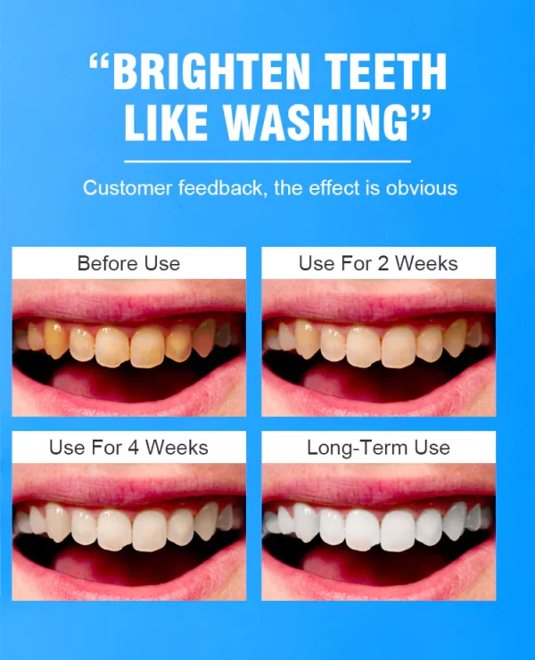 AUOUESTWhitening&Tooth Strengthening Mousse