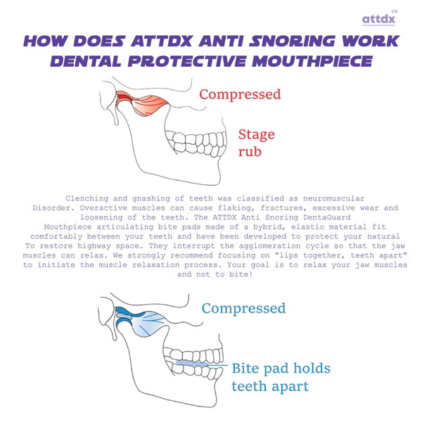 ATTDX AntiSnoring DentaGuard Mouthpiece