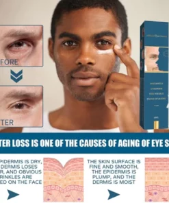 Moonkf™ Deep Wrinkle Filler