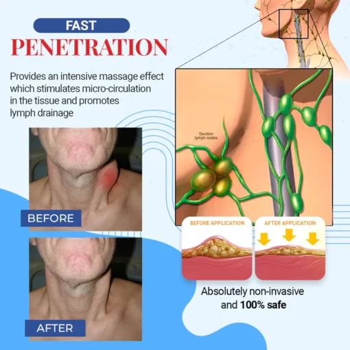 Ceoerty™ ThyroHeal kilpirauhasen imusolmukelaastari - kuva 4