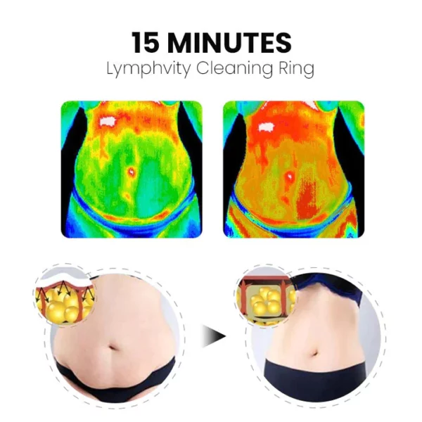 Oveallgo Alize MagneTech Lymphvity Cleansing Ring