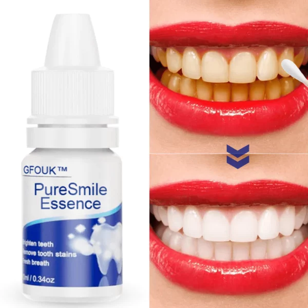 GFOUK PureSmile Essence