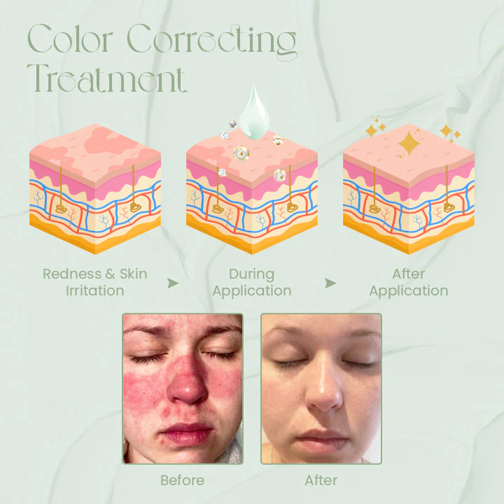 Ceoerty™ ToneTreat Skin Correcting Treatment Cream - Image 3